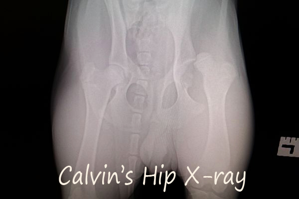 Calvin's Dislocated Hip